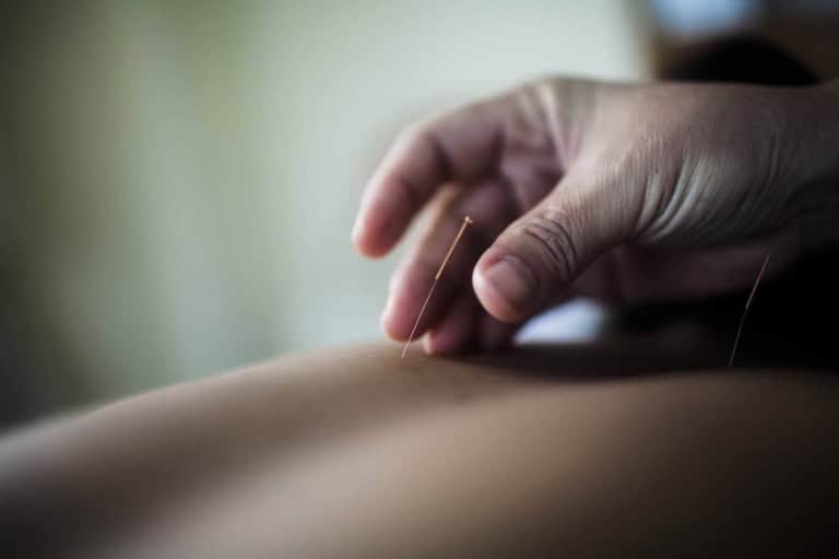 The Benefits of Acupuncture for Women’s Hormonal Health
